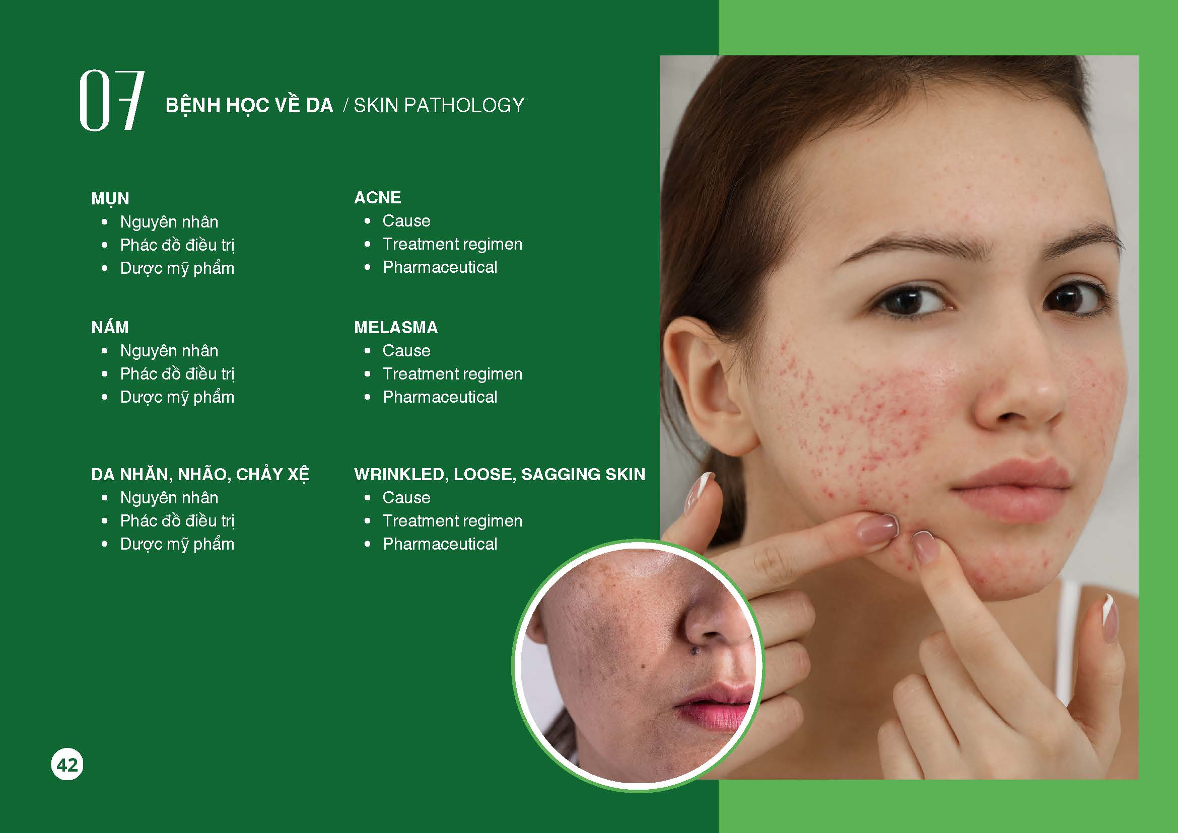 Catalog Vo Dung Final Page 44